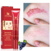 Acne Scar Removal Cream