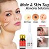 Mole removal cream