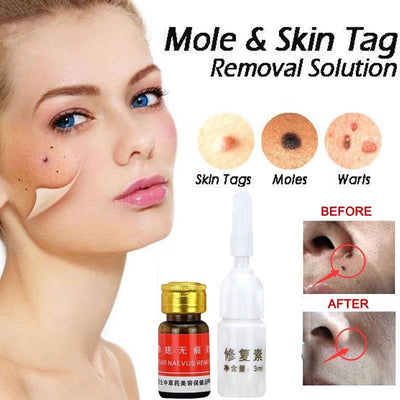 Mole removal cream