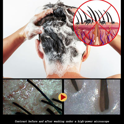 Scalp Hair Follicle Shampoo